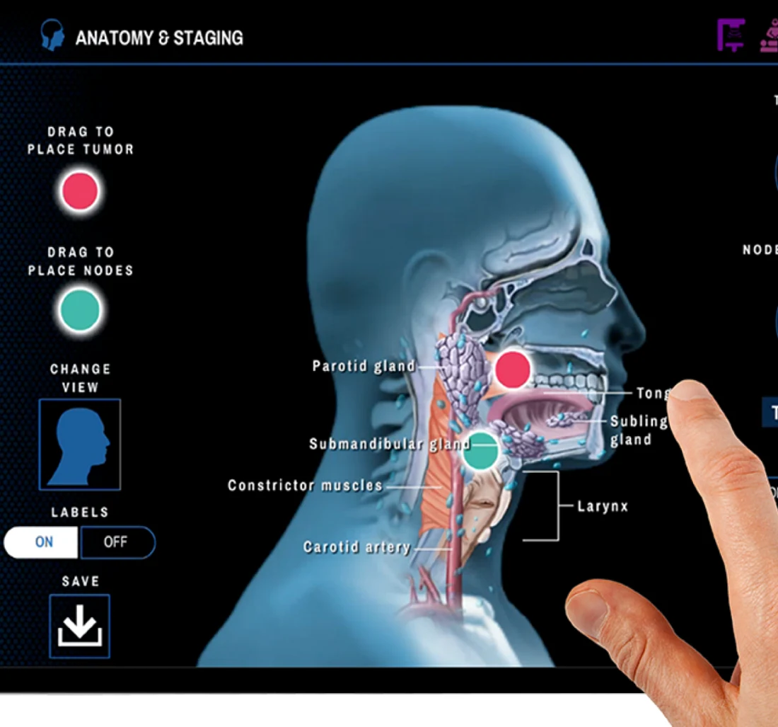 Illustrative anatomy and staging screen for a shared oncology consultation.
